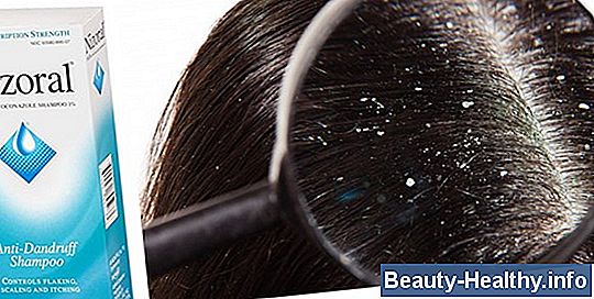 ¿Qué causa el pelo gris en adolescentes?
