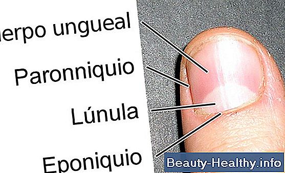 ¿Cuáles son los síntomas de una fractura por estrés en el pie?