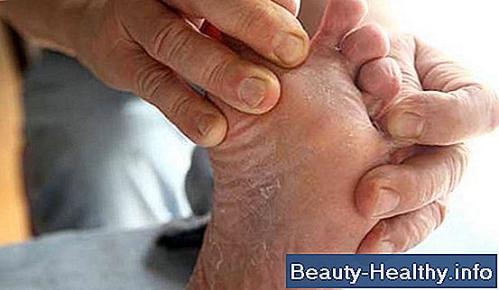 ¿Qué causa que los pies se hinchen?