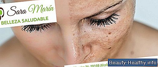 ¿Qué es la enfermedad reactiva de las vías respiratorias?