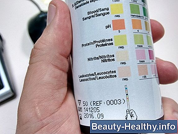¿Qué es la prueba de sangre con TSH?
