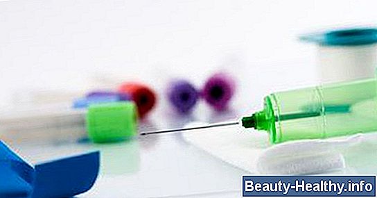 ¿Qué es MCHC en una prueba de sangre?