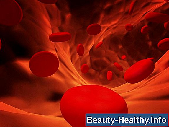 ¿Qué es un análisis de sangre en un panel de lípidos?