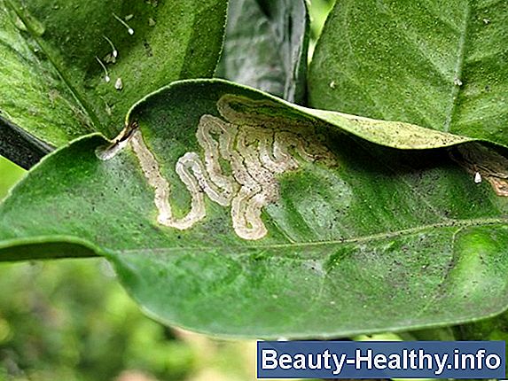 ¿Qué insectos infectan el cabello humano?