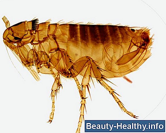 ¿Qué picaduras de insectos causan ampollas?