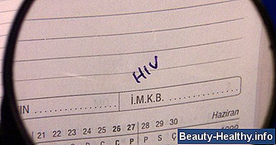 驴Qu茅 significa una prueba de VIH no reactiva?