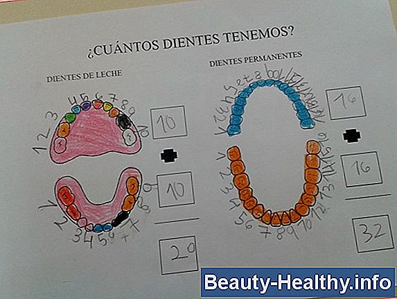 ¿Qué son las dentaduras permanentes?