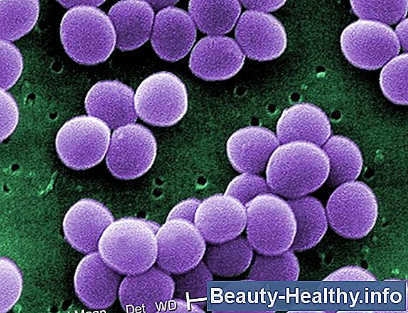 Quemaduras urinarias sin infecci贸n