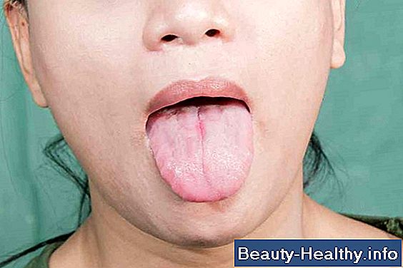 Razones para una lengua sangrante