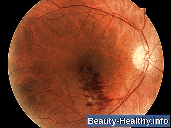 Signos y s铆ntomas de la enfermedad vascular