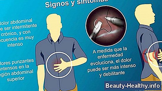 Signos y síntomas de inflamación de la vesícula biliar