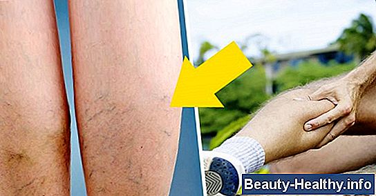 Signos y S铆ntomas de Mala Circulaci贸n en los Pies y Piernas