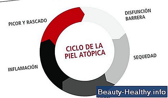 Signos y Síntomas de una Alergia al Tabaco