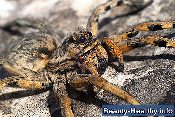 Síntomas comunes de una mordedura de araña de casa