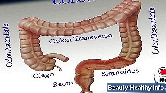 S铆ntomas de colitis y diverticulitis