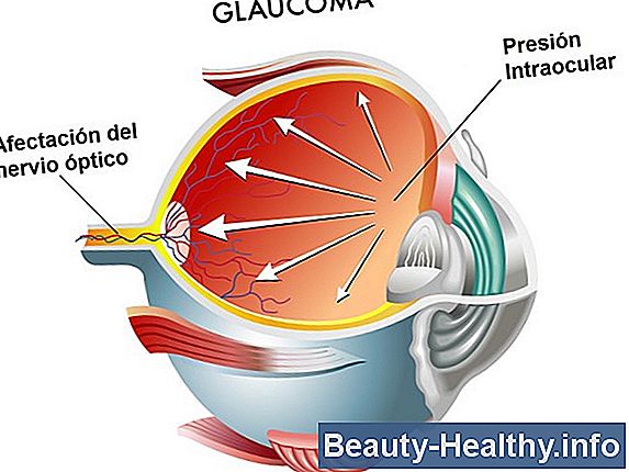 S铆ntomas de presi贸n ocular