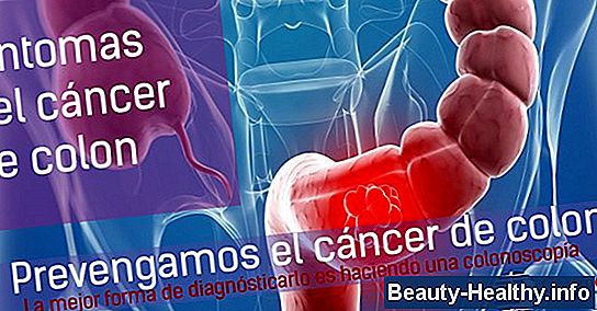 Síntomas del cáncer de colon avanzado