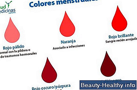 Menopausia y Hemorroides hemorrágicas