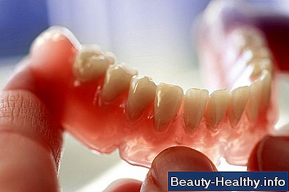 Tipos de dentaduras ultra delgadas