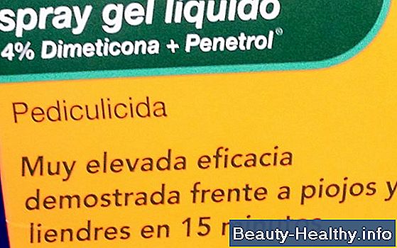 Tratamiento con dimeticona para los piojos