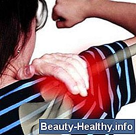 Arthritis Symptomer i nakke og skuldre
