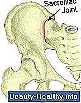 Cómo lidiar con el dolor articular sacroilíaco