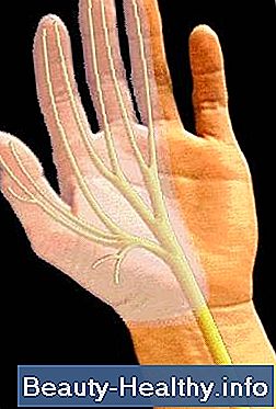 C贸mo tratar la neuritis y la neuralgia