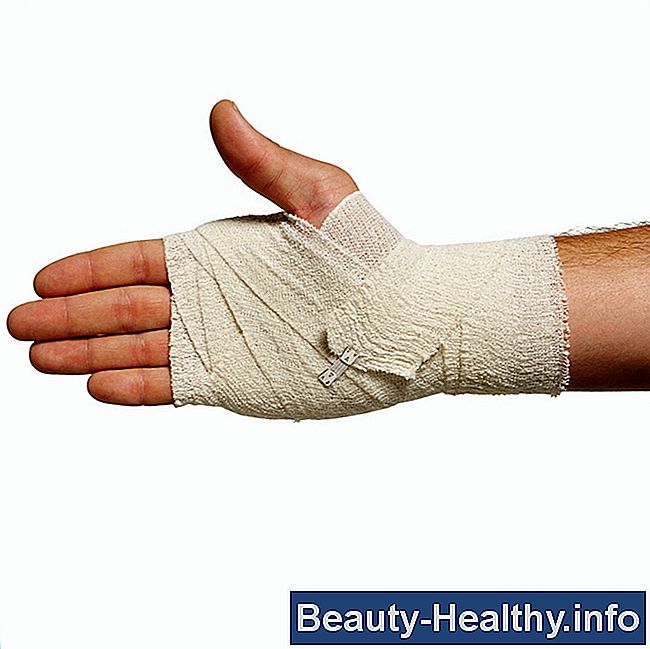 Cómo tratar un esguince pulgar