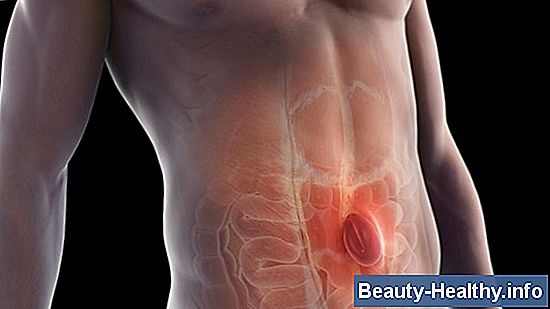 Burst Hernia Symptom