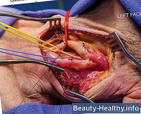 Carotid Artery Vs. Jugular Vein
