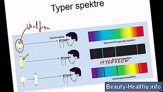 Hva er total opacifisering av den maksillære sinus?