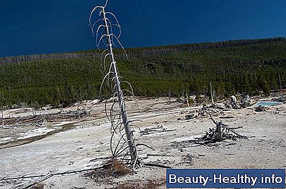 Kalsium Deposit Symptomer