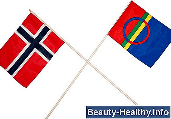 Slik bruker du et bryterpanel for racerbiler