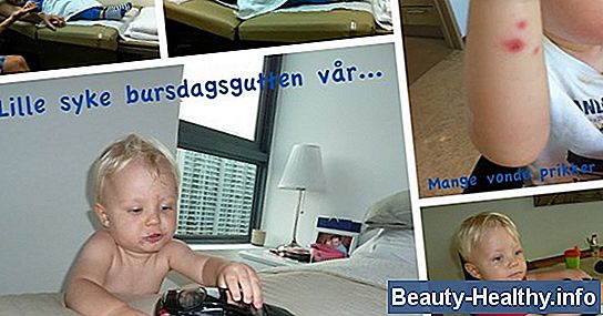 Virus Symptomer Uten Feber