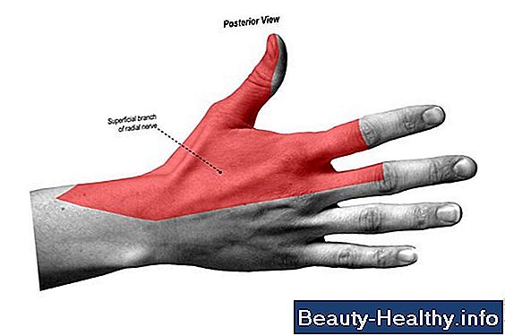 Om Degenerativ Spondylose
