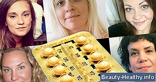 Biverkningar och symtom på lågt östrogen