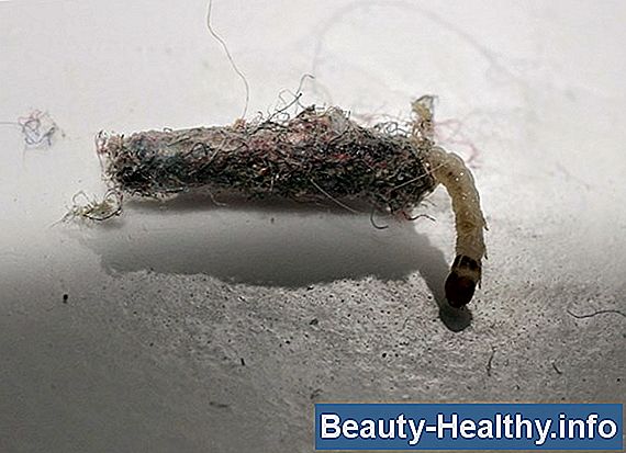 Hur bli av med Tinea Versicolor (Pityriasis Versicolor) Hudtillstånd