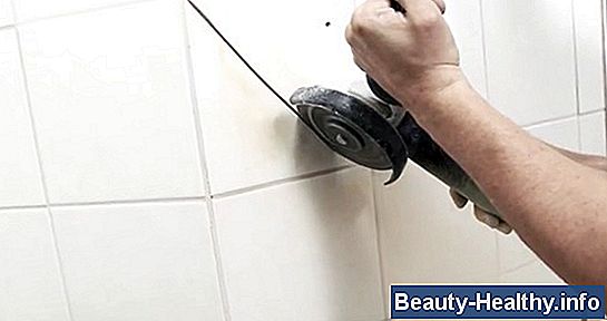 Hur man tar bort kolesterolpålagringar på ögonlocket