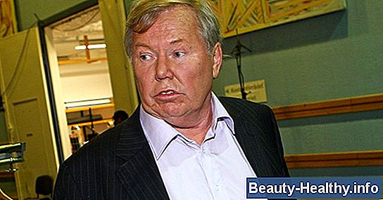 Hur man vet om du har ett fall av huvudlöss