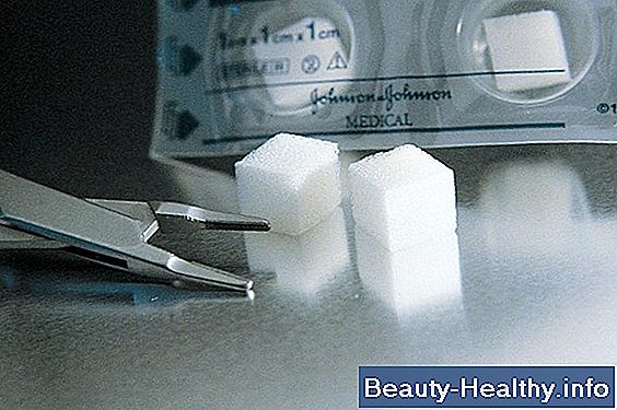 Vad är en intraoral periapical röntgen?