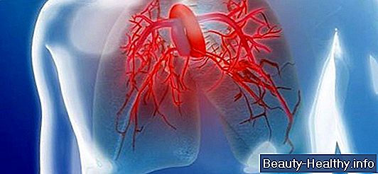 ¿Qué es la hipertensión pulmonar?