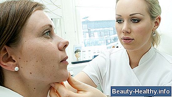 Hva er behandlinger for kreosot hudbrann?